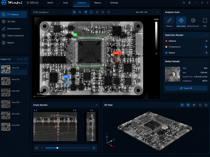 อินเทอร์เฟซซอฟต์แวร์ X-Mind วิเคราะห์ภาพ X-ray
